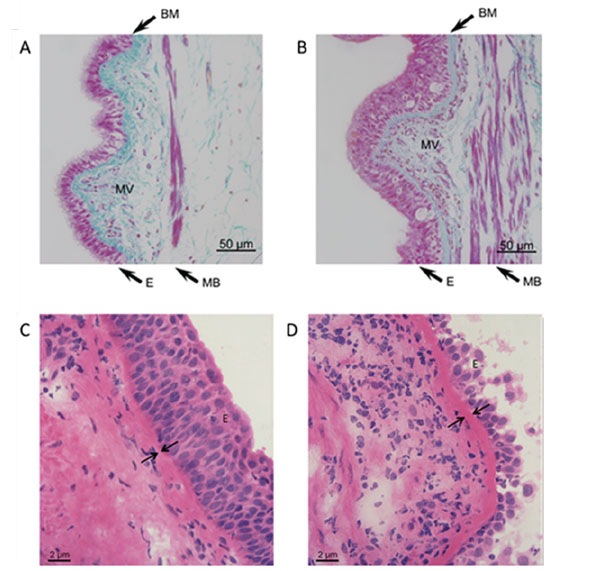 The Three A’s in Asthma – Airway Smooth Muscle, Airway Remodeling ...